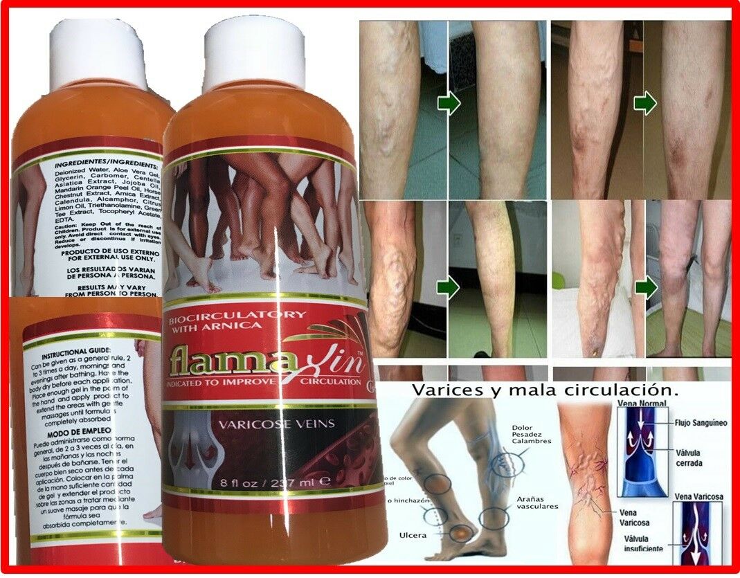 Medic Herbal Ointment Varicose Veins Vasculitis Treatment Foot Care Cream Leg Us