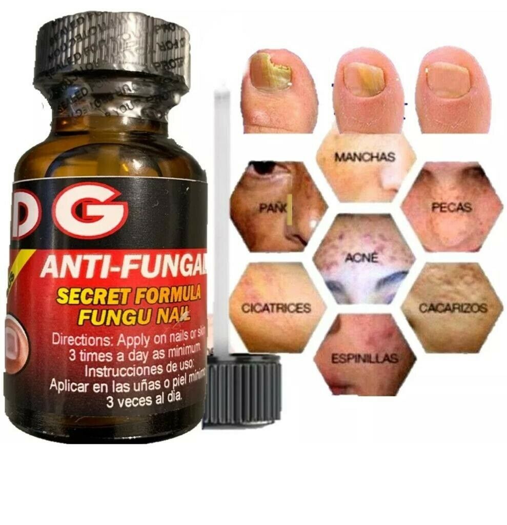 Anti Fungal Treatment Extra Strength Toenail Fungus Athletes Foot Fungi Nail #1