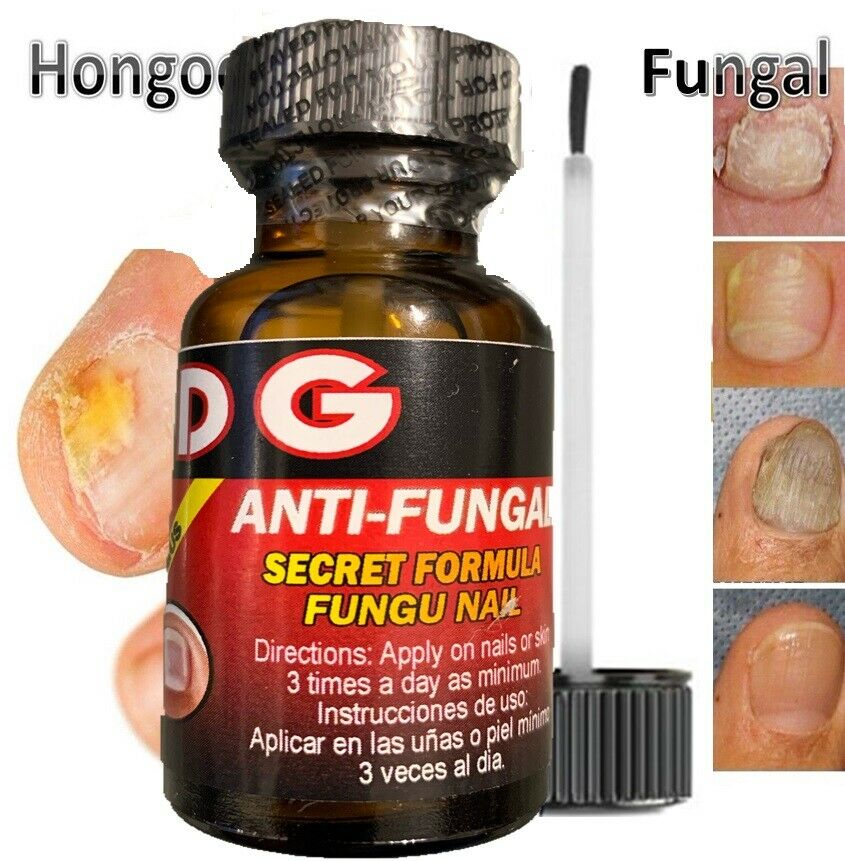 Hongo Cura Best Nail Fungal Killer Fast Cure Best Product Zana Cure Nails Quick